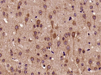 Anti-Biglycan antibody used in IHC (Paraffin sections) (IHC-P). GTX57229