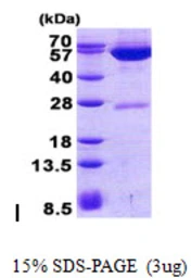 Human GPT2 protein, His tag. GTX57242-pro