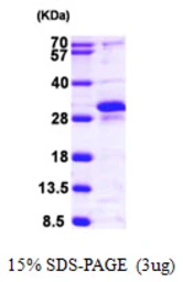 Human RERG protein, His tag. GTX57255-pro
