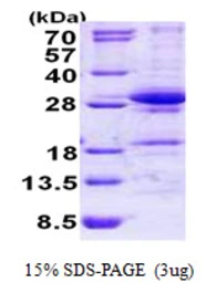 Human DGCR6L protein, His tag. GTX57257-pro