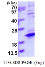 Human TCEAL8 protein, His tag. GTX57265-pro
