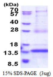 Human CDKN2AIPNL protein, His tag. GTX57267-pro