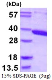 Human ACY3 protein, His tag. GTX57269-pro