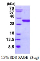 Human UBTD2 protein, His tag. GTX57272-pro