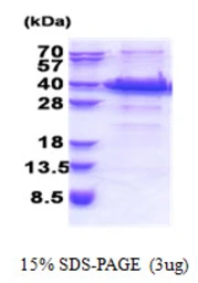 Human Fank1 protein, His tag. GTX57275-pro