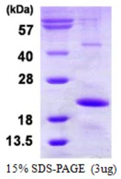 Human HSPB9 protein, His tag. GTX57282-pro