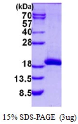 Human SAT2 protein, His tag. GTX57289-pro
