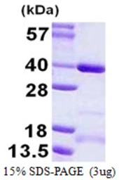 Human CCDC101 protein, His tag. GTX57292-pro