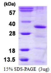 Human HAUS1 protein, His tag. GTX57299-pro