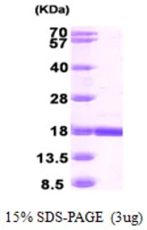 Human RBP7 protein, His tag. GTX57304-pro