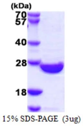 Human SENP8 protein, His tag. GTX57315-pro