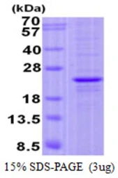 Human FOPNL protein, His tag. GTX57317-pro
