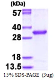 Human OVCA2 protein, His tag. GTX57319-pro