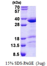 Human CCDC43 protein, His tag. GTX57321-pro