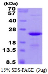 Human C17orf49 protein, His tag. GTX57322-pro