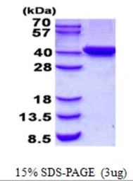Human C2orf60 protein, His tag. GTX57328-pro