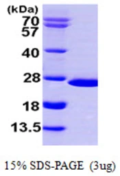 Human NUDT16 protein, His tag. GTX57331-pro