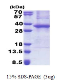 Human ASB8 protein, His tag. GTX57344-pro