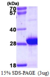 Human MLC1SA protein, His tag. GTX57345-pro