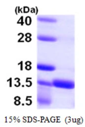 Human S100A16 protein, His tag. GTX57346-pro