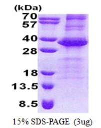 Human NEURL2 protein, His tag. GTX57350-pro