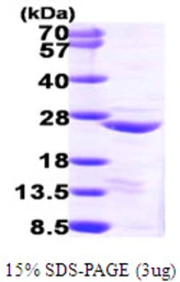 Human COMMD1 protein, His tag. GTX57364-pro