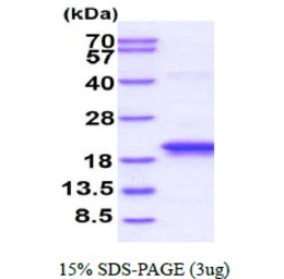 Human GLIPR2 protein, His tag. GTX57366-pro