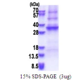 Human ADAL protein, His tag. GTX57372-pro