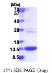 Human COMMD6 protein, His tag. GTX57377-pro