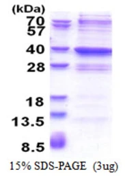 Human GLYATL2 protein, His tag. GTX57388-pro