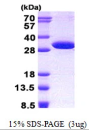 Human NUDT14 protein, His tag. GTX57399-pro
