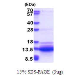 Human SVIP protein, His tag. GTX57402-pro