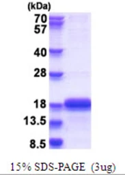 Human SELH protein, His tag. GTX57405-pro