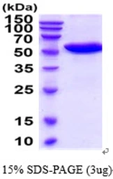 Mouse CNDP1 protein, His tag. GTX57411-pro