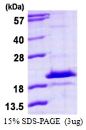 Human HDDC3 protein, His tag. GTX57418-pro