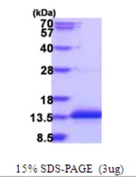 Human CCDC23 protein, His tag. GTX57419-pro