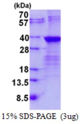 Human LIN28B protein, His tag. GTX57427-pro
