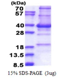 Human CENPP protein, His tag. GTX57430-pro