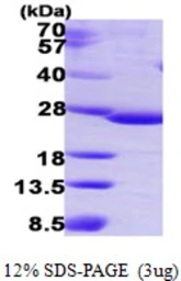 Human C9orf103 protein, His tag. GTX57435-pro