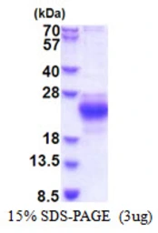 Human CHAC2 protein, His tag. GTX57441-pro