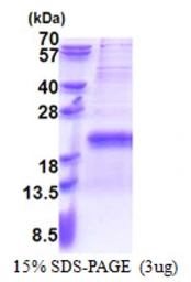 Human TXNRD3NB protein, His tag. GTX57446-pro