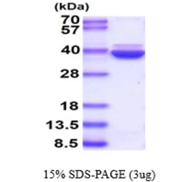 Human Annexin VIII protein, His tag. GTX57449-pro