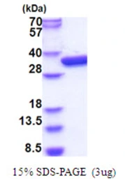 E. coli glk protein, His tag. GTX57476-pro