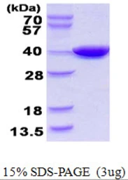 E. coli CoaA protein, His tag. GTX57494-pro