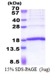 Human KHDC1L protein, His tag. GTX57502-pro