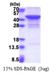Human JMJD7 protein, His tag. GTX57507-pro