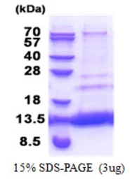 Human CMC4 protein, His tag. GTX57508-pro
