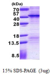 Human FSBP protein, His tag. GTX57510-pro