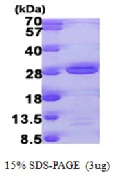 Human AK6 protein, His tag. GTX57511-pro
