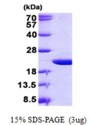 Human OMP protein, His tag. GTX57529-pro